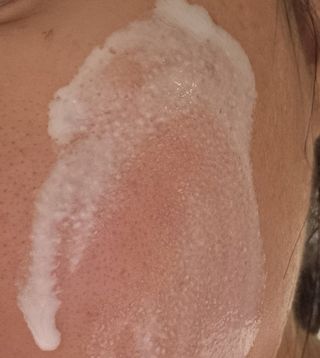 프리 (인스타체험단) [밀리밀리] 메디 앰플 콜라 15ml — 5점을 준 리뷰어가 2025년 9월 올린 사용 사진