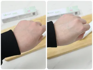 건선/아토/습진/민감성 피부 천연보습진정크림 소리온 크림 & 센시티브 크림 50g — 5점을 준 리뷰어가 2022년 1월 올린 사용 사진