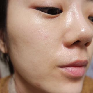 바이리뮤 에이지 홀딩 펩타톡스 앰플 — 4.5점을 준 리뷰어가 2020년 12월 올린 사용 사진