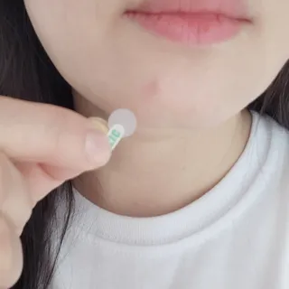 [큐어반H 스팟] 자외선 99프로 차단되는 스틱타입 스팟밴드(1팩 / 66매입) — 5점을 준 리뷰어가 2022년 12월 올린 사용 사진