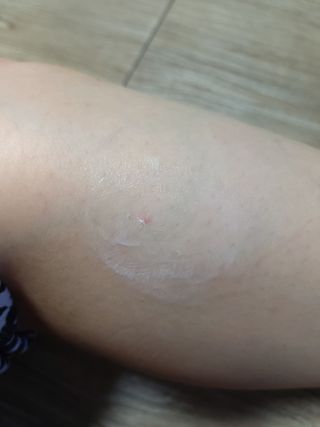 젠바이오 코스메틱스 젠바이오수딩크림]   가려운 피부 & 아토피 원픽 크림 — 5점을 준 리뷰어가 2022년 9월 올린 사용 사진