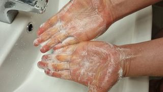 닥터시드 티트리 앤 라임 비건 지성케어 쿨 탈모 두피 워터 스케일러 — 5점을 준 리뷰어가 2024년 5월 올린 사용 사진