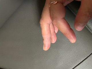 [큐어반H 커팅] 간편하게 떼서 쓰는 자외선차단 습윤밴드 (1팩/30매입) — 5점을 준 리뷰어가 2022년 12월 올린 사용 사진