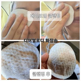 디어엘로디 무표백 021패드  12개세트 — 5점을 준 리뷰어가 2022년 11월 올린 사용 사진