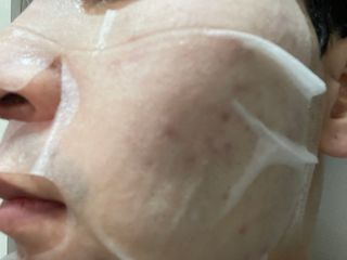 체르엠 그린 케비어 더블워터 마스크팩 5매입  2팩 — 5점을 준 리뷰어가 2021년 12월 올린 사용 사진