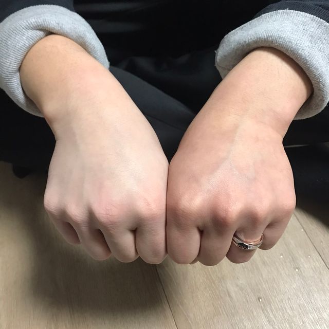 매직피치 화이트닝 파워 화이트닝크림 리뷰 사진