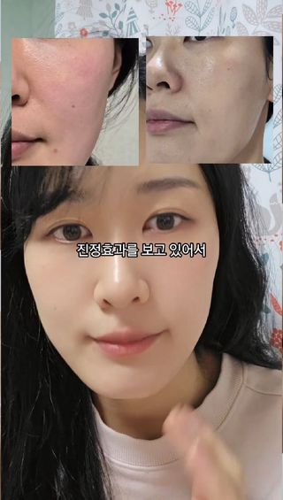 틱톡 캠페인 ★ ｜ Tiktok x 0.8L 에스트라리제덤 2차 크림 (최종) — 5점을 준 리뷰어가 2025년 2월 올린 사용 사진