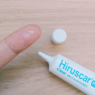 히루스카 포스트아크네 클리어 — 4점을 준 리뷰어가 2021년 2월 올린 사용 사진