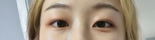 나나스킨 콤플렉스씨쓰리닥터클리어앰플 — 5점을 준 리뷰어가 2021년 6월 올린 사용 사진