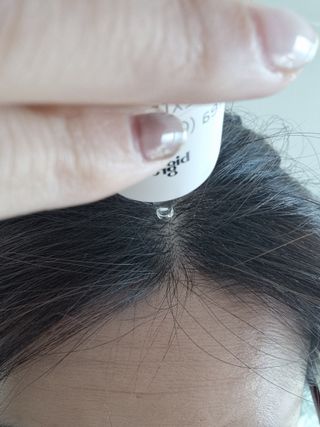 빅그린 프리미어 바이옴 앰플팩 - 두피탈모관리용 — 5점을 준 리뷰어가 2022년 12월 올린 사용 사진