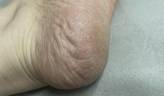 한화핫도그녀님이 올린 리뷰 사진 2