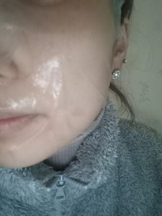 닥터마시멜로 닥터마스멜로 마블러스 아쿠아 클리닉 마스크 — 5점을 준 리뷰어가 2021년 3월 올린 사용 사진