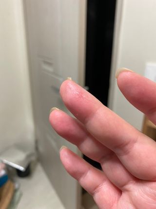 아이디플라코스메틱 아이디 페이스핏 마이너스 밴드 v2 — 5점을 준 리뷰어가 2020년 12월 올린 사용 사진