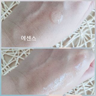 체르엠 비타민 브라이트닝 에센스 + 콜라겐앰플 세트 — 5점을 준 리뷰어가 2021년 7월 올린 사용 사진