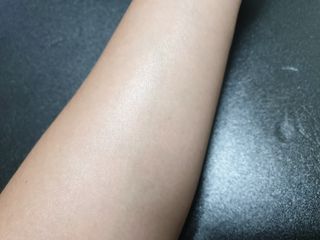 바이오오일 [바이오-오일] 스킨케어 오일 내추럴 60ml — 3.5점을 준 리뷰어가 2021년 11월 올린 사용 사진