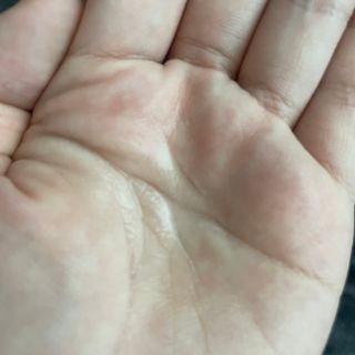 [후르디아] 등드름 잡는 바디 미스트 2개 세트 — 5점을 준 리뷰어가 2021년 6월 올린 사용 사진