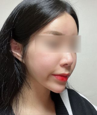 스킨큐어 산다화 비타민c 화이트닝 에센스 30ml — 4.5점을 준 리뷰어가 2023년 10월 올린 사용 사진