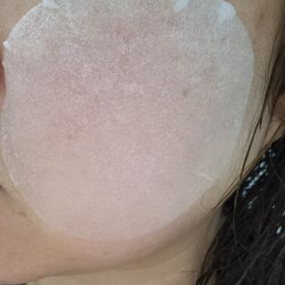 랑벨 랑바이오 블랙 시카 퀵 패드 100매 (3초 쿨링/3분 흡수, 블랙비 프로폴리스/시카 4종 함유, 대용량) — 4.5점을 준 리뷰어가 2022년 5월 올린 사용 사진