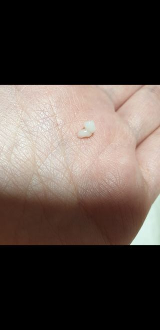 바르셀 주름개선 리프팅 영양크림 인텐시브 리포좀 더블크림-C2 50ml — 5점을 준 리뷰어가 2021년 11월 올린 사용 사진