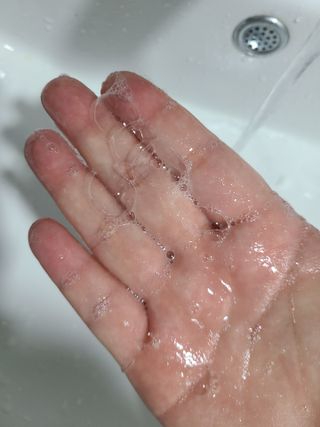 어라운드미 [어라운드 미] 탈모 증상 완화 스칼프 샴푸 + 두피 영양 공급 트리트먼트 — 5점을 준 리뷰어가 2021년 7월 올린 사용 사진