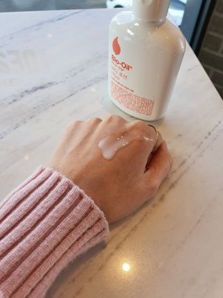 바이오오일 [바이오-오일] 바디 로션 175ml — 5점을 준 리뷰어가 2021년 11월 올린 사용 사진