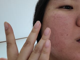 [녹산] 비건 대나무 밸런싱 수분 토너 + 비건 바이오 비타 에센스 — 5점을 준 리뷰어가 2022년 10월 올린 사용 사진