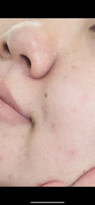 📷프리 (인스타체험단) [밀리밀리] 메디 앰플 비타 15ml — 5점을 준 리뷰어가 2025년 9월 올린 사용 사진