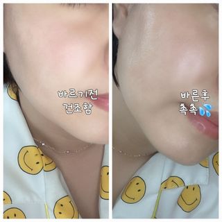 씽크바이오 히알루론 에센스 에어볼 28ea — 5점을 준 리뷰어가 2022년 9월 올린 사용 사진