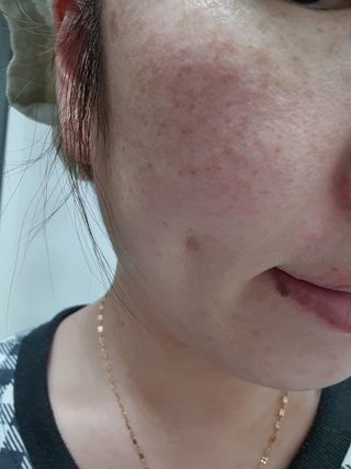 메디필 레드 락토 콜라겐 크림 — 5점을 준 리뷰어가 2021년 1월 올린 사용 사진
