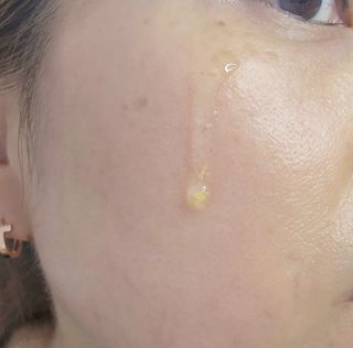 에센느 닥터 멜라닌 화이트닝 앰플 — 5점을 준 리뷰어가 2023년 4월 올린 사용 사진