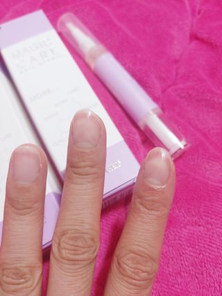 뷰젤 매직케어 네일솔루션 손발톱 보습 영양제 펜슬타입 5ml — 5점을 준 리뷰어가 2022년 3월 올린 사용 사진