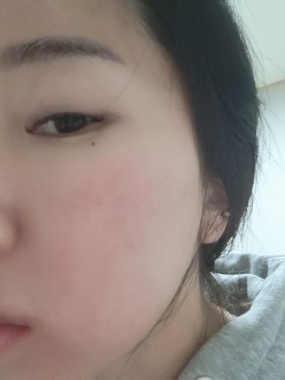 체르엠  프루브 콜라겐 앰플세럼 60ml 1병 — 5점을 준 리뷰어가 2022년 1월 올린 사용 사진