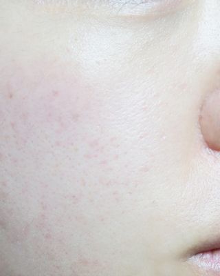 [NEW 탄력유턴 아이크림] AHC 유스 래스팅 리얼 아이크림 포 페이스 — 5점을 준 리뷰어가 2021년 3월 올린 사용 사진