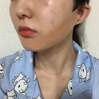 아이디플라코스메틱 아이디 페이스핏 마이너스 밴드 v2 — 2.5점을 준 리뷰어가 2021년 5월 올린 사용 사진