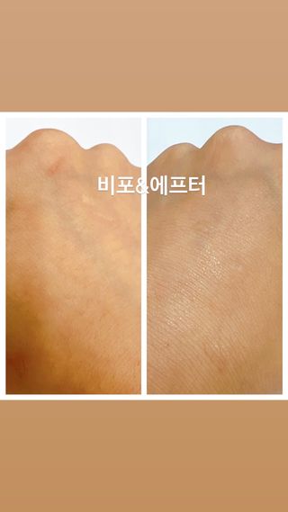 ★뉴 펩타이드 부스터 리커버리 앰플 — 5점을 준 리뷰어가 2022년 7월 올린 사용 사진