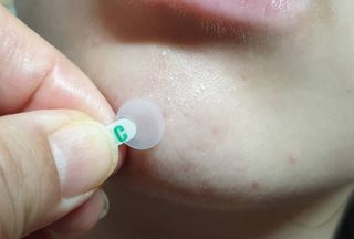 [큐어반H 스팟] 자외선 99프로 차단되는 스틱타입 스팟밴드(1팩 / 66매입) — 5점을 준 리뷰어가 2022년 11월 올린 사용 사진