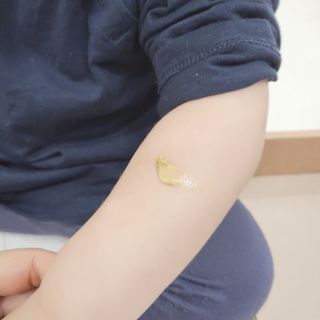 건선/아토/습진/민감성 피부 천연보습진정크림 소리온 크림 & 센시티브 크림 50g — 5점을 준 리뷰어가 2022년 1월 올린 사용 사진