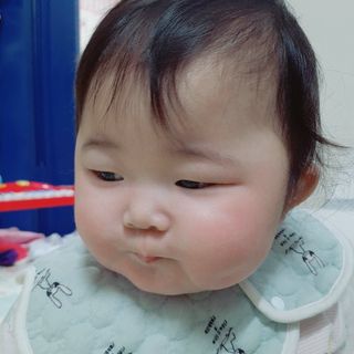 건선/아토/습진/민감성 피부 천연보습진정크림 소리온 크림 & 센시티브 크림 50g — 5점을 준 리뷰어가 2022년 2월 올린 사용 사진