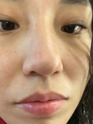 세뚜아(Cettua) 세뚜아 스티키 포어 패치 Cettua Sticky Pore Patch — 5점을 준 리뷰어가 2023년 8월 올린 사용 사진