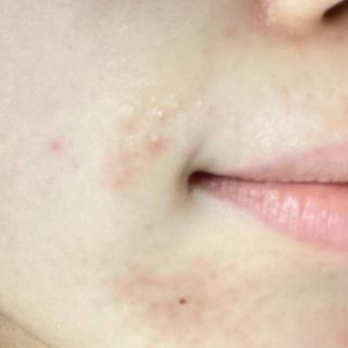 리더스코스메틱 리더스 카밍 바이오틱스 크림 마스크 — 5점을 준 리뷰어가 2021년 4월 올린 사용 사진