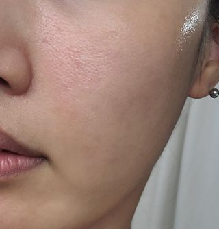 더마 사이언스 비타민 CCC 앰플 기미 브라이트닝 세럼 30ml — 5점을 준 리뷰어가 2021년 8월 올린 사용 사진