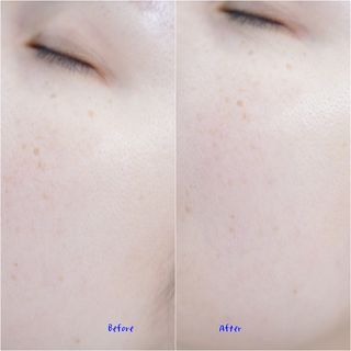 생크몽드 피토 필링 로션 150ml — 5점을 준 리뷰어가 2021년 8월 올린 사용 사진