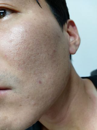플리프 시카 알로에 스팟키트 — 4점을 준 리뷰어가 2021년 4월 올린 사용 사진