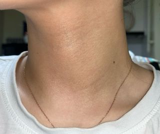 바노바기 코스메틱 피디알엔 리페어 리얼 밤 9g — 5점을 준 리뷰어가 2023년 10월 올린 사용 사진