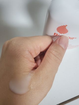 바이오오일 [바이오-오일] 바디 로션 175ml — 4점을 준 리뷰어가 2021년 10월 올린 사용 사진