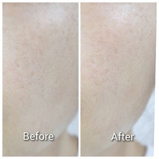 리엔케이 셀투셀 에센스 듀오 (40mL x 2ea) — 5점을 준 리뷰어가 2022년 12월 올린 사용 사진