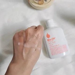 바이오오일 [바이오-오일] 바디 로션 175ml — 5점을 준 리뷰어가 2021년 10월 올린 사용 사진