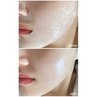 메디힐 올리브영 1등 마스크팩 워터마이드팩 2매 + 티트리팩 2매 기획세트 — 5점을 준 리뷰어가 2021년 3월 올린 사용 사진