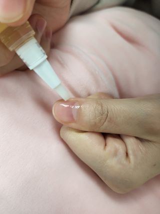 뷰젤 매직케어 네일솔루션 손발톱 보습 영양제 펜슬타입 5ml — 5점을 준 리뷰어가 2022년 3월 올린 사용 사진
