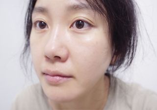 프리 (블로그체험단) [밀리밀리] 메디 앰플 시카 15ml — 5점을 준 리뷰어가 2025년 7월 올린 사용 사진